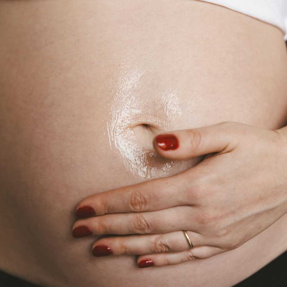 איך למנוע סימני מתיחה בהריון פיטולסטיל ג'ל ליראק